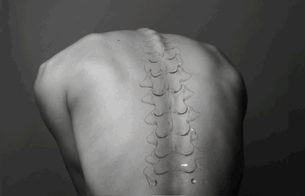 Pabla’s successfully settle complex cumulative back injury claim
