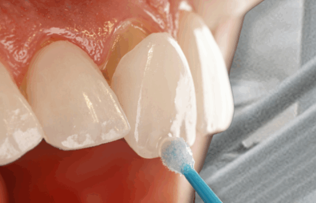 Day in the life of a dentist; broken NHS, Turkey teeth