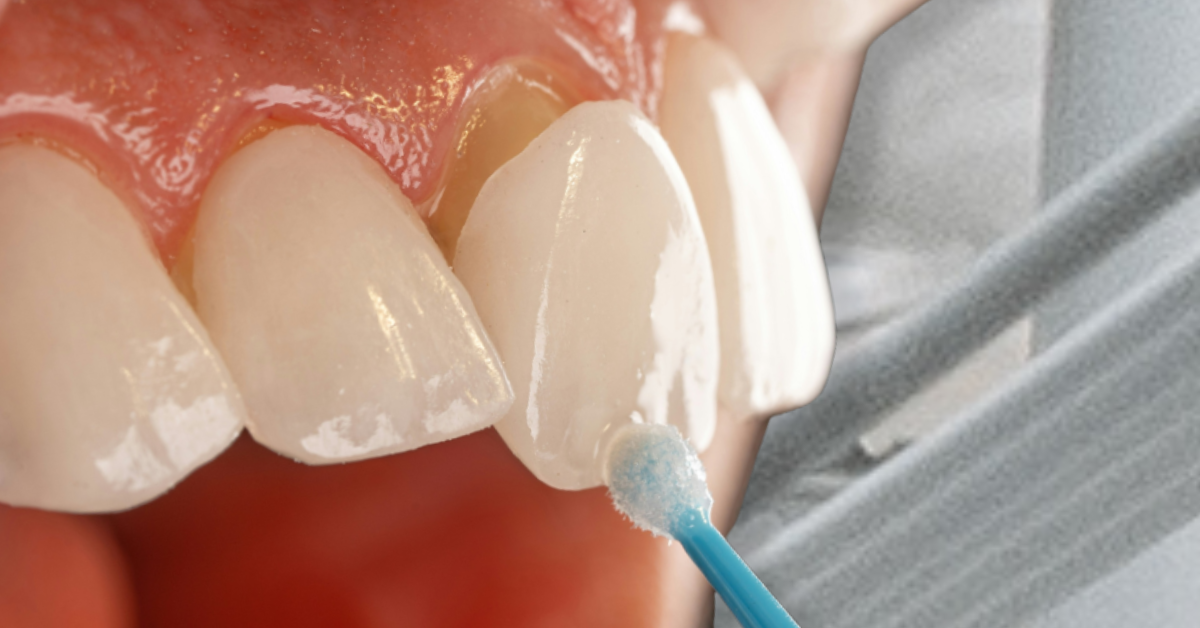 Day in the life of a dentist; broken NHS, Turkey teeth
