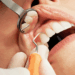 Teeth are inspected by a presumably negligent NHS doctor, who is on the cusp of irreversibly damaging several of them.