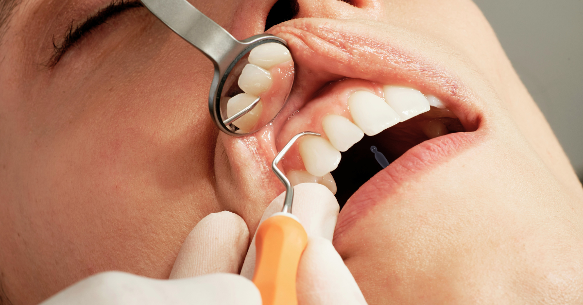 Complaints about NHS dental services rise 66% in five years
