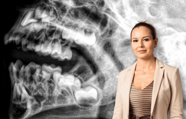 Botched dental surgery case successfully settled for £78,000