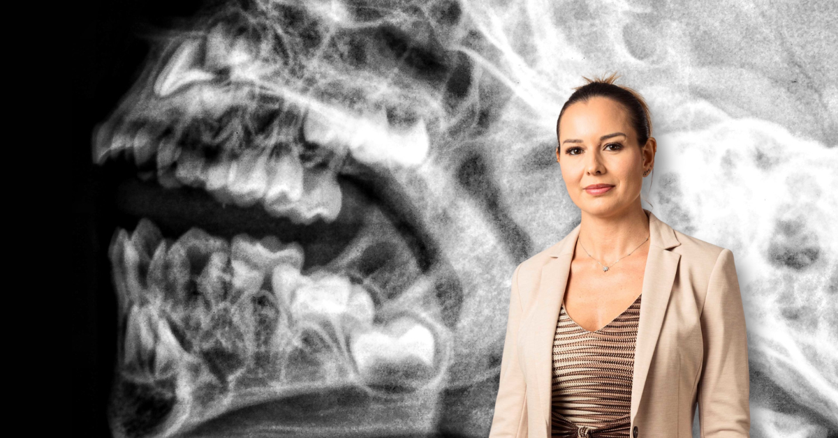 Botched dental surgery case successfully settled for £78,000