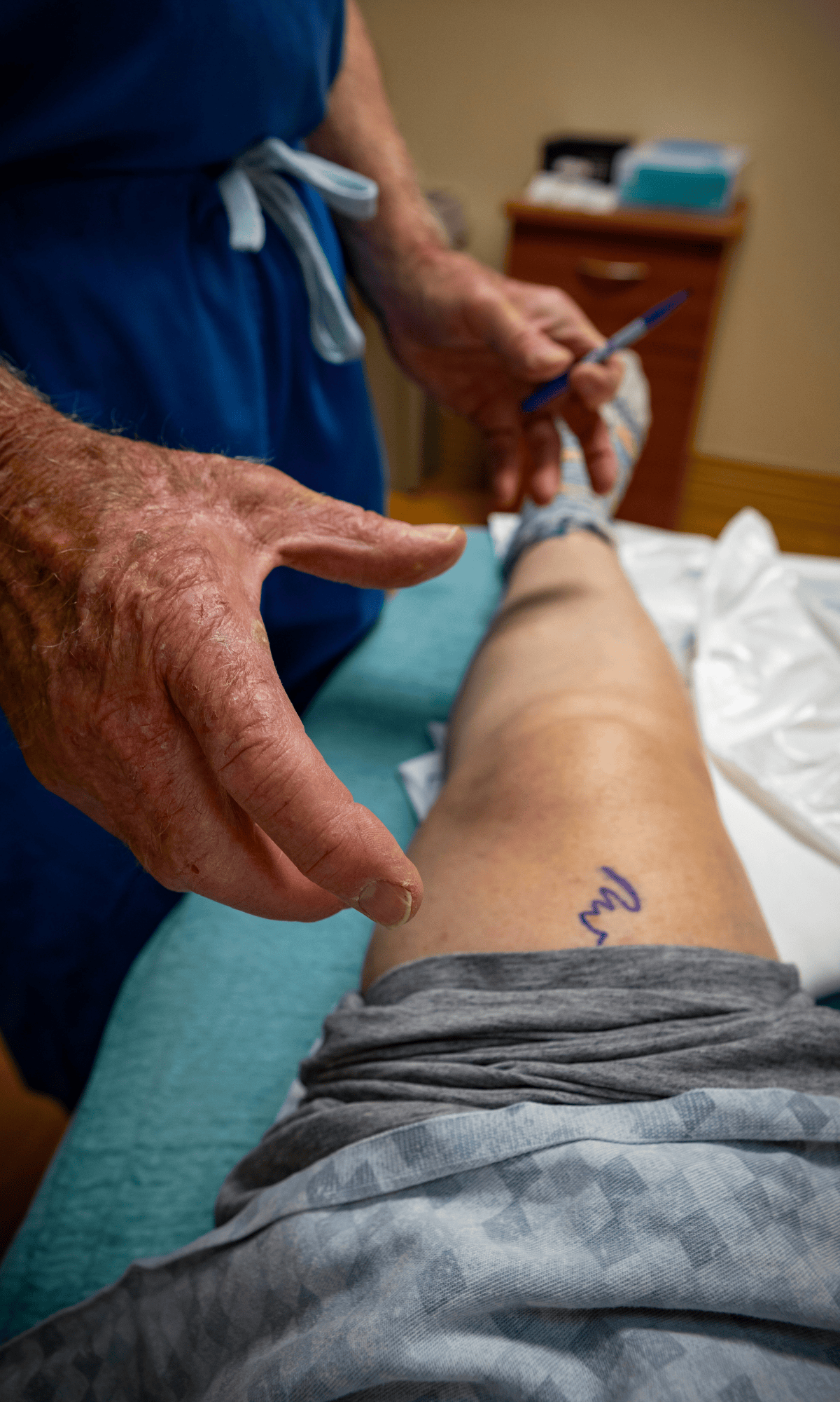 A doctor specialising in lower limb injuries hovers his wisened hands over the leg of a patient. He has drawn on the leg, close to where he will presumably soon operate.